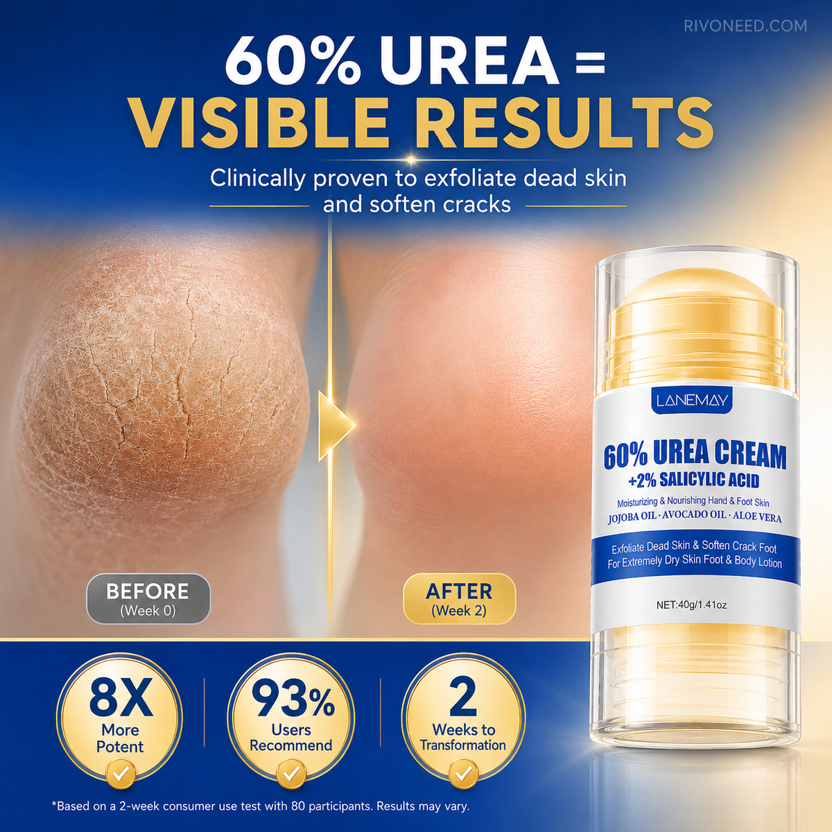 🔥 OFFERTA – Crema piedi anti-screpolature, idratazione intensiva in un solo gesto! 👣✨