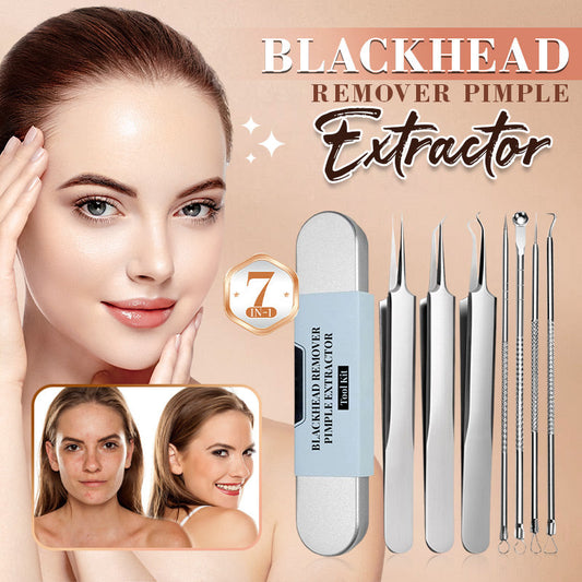 💓 SALDO 2026 – 50% DI SCONTO 💥 Kit per l'estrazione di punti neri di grado medico – strumenti professionali per una pelle pulita e senza imperfezioni! 🧴🪞✨