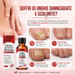 ✨ Il Regalo Perfetto per le Tue Unghie – 50% di SCONTO! Essenza Riparatrice che Nutre, Rinforza e Ripara le Unghie Danneggiate! 🌟💅