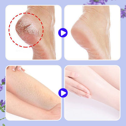 Balsamo Riparatore Nutriente Anti-Screpolature per i Piedi