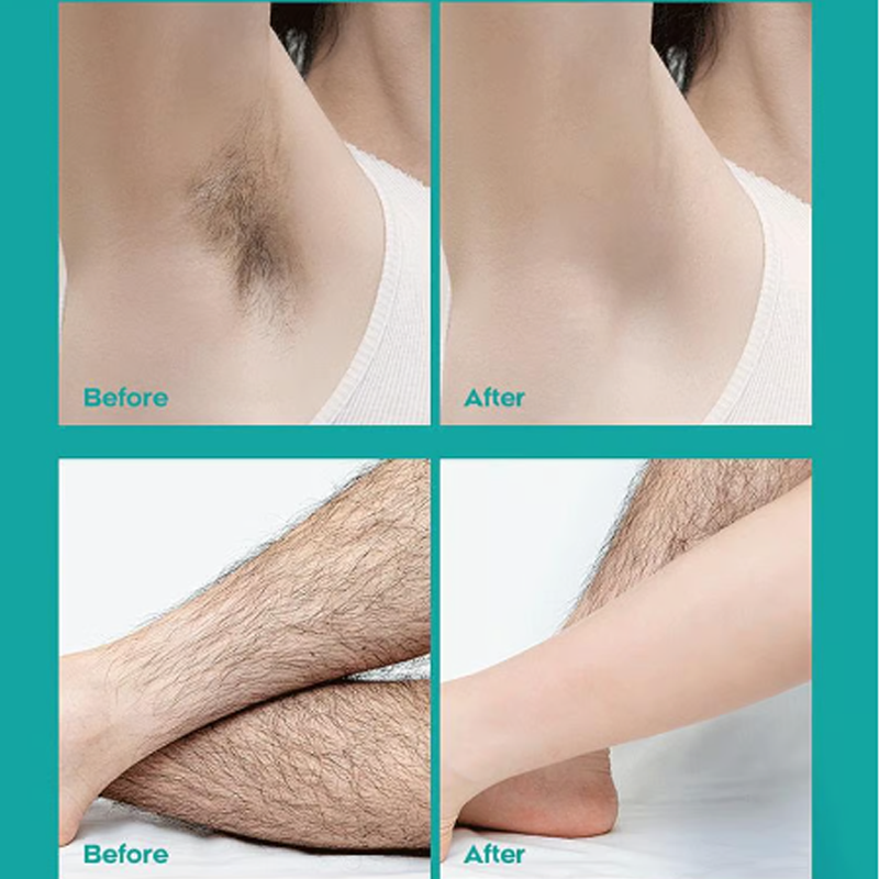 Crema depilatoria indolore per tutto il corpo