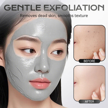 Stick Maschera all'Argilla all'Acido Azelaico 40 g