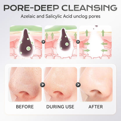 Stick Maschera all'Argilla all'Acido Azelaico 40 g