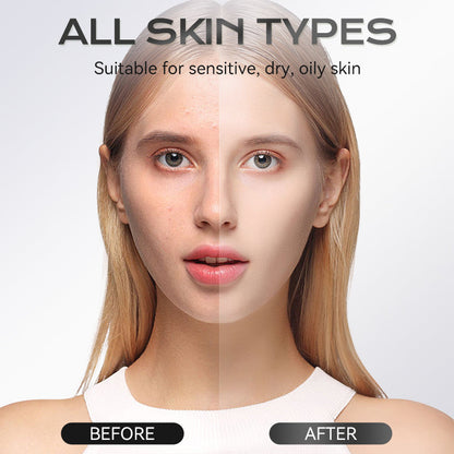 Stick Maschera all'Argilla all'Acido Azelaico 40 g