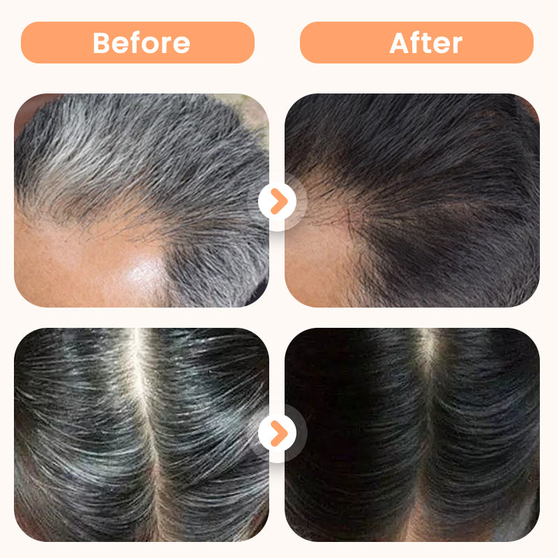 💆‍♀️🌿Tintura per capelli con estratti vegetali per capelli grigi