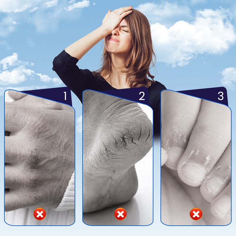 Cerotto riparatore di pelle screpolata per mani e piedi