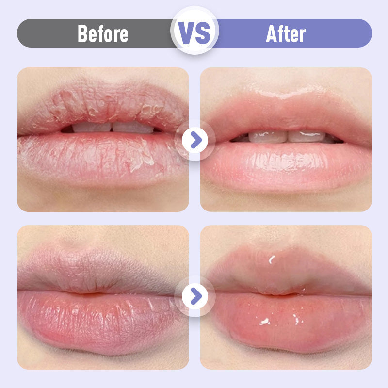 🔥Nuova collezione 2026: sconto del 50% solo per un periodo limitato!💋Rimpolpante & Antirughe Idratante Siero labbra