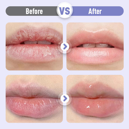 🔥Nuova collezione 2026: sconto del 50% solo per un periodo limitato!💋Rimpolpante & Antirughe Idratante Siero labbra