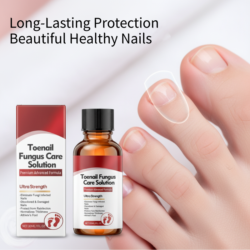 ✨ Il Regalo Perfetto per le Tue Unghie – 50% di SCONTO! Essenza Riparatrice che Nutre, Rinforza e Ripara le Unghie Danneggiate! 🌟💅