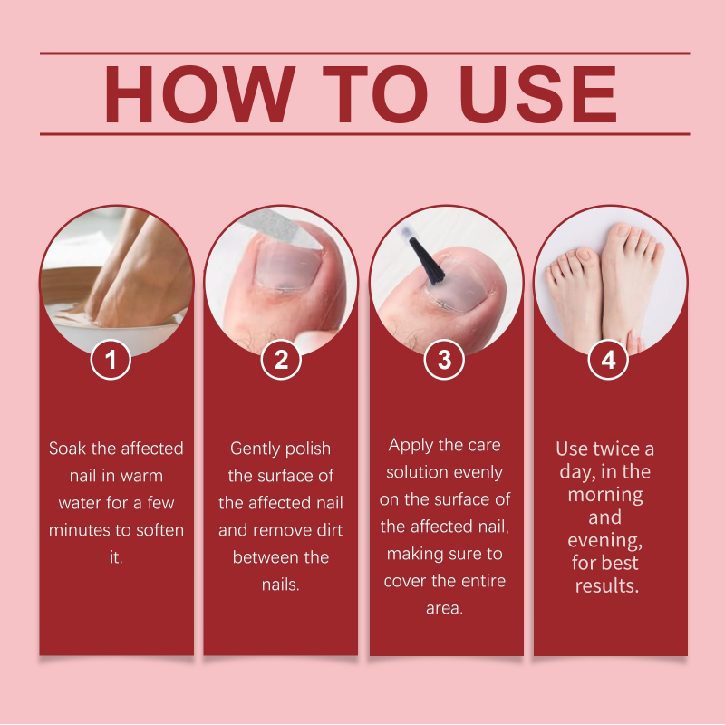 ✨ Il Regalo Perfetto per le Tue Unghie – 50% di SCONTO! Essenza Riparatrice che Nutre, Rinforza e Ripara le Unghie Danneggiate! 🌟💅