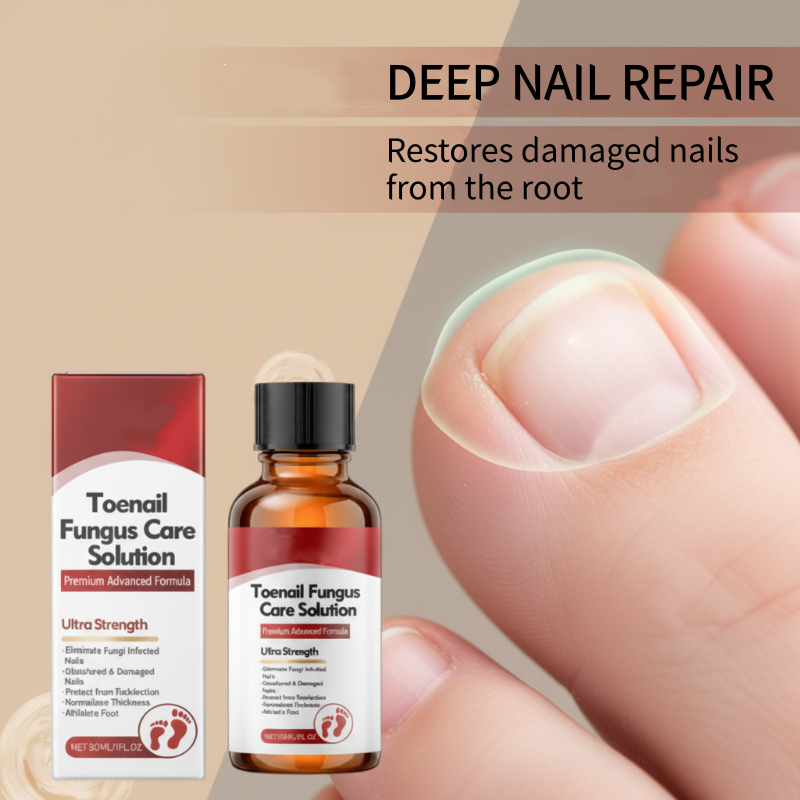 ✨ Il Regalo Perfetto per le Tue Unghie – 50% di SCONTO! Essenza Riparatrice che Nutre, Rinforza e Ripara le Unghie Danneggiate! 🌟💅
