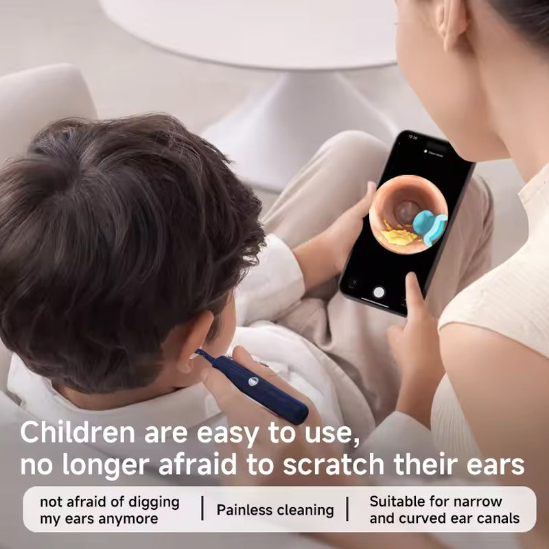 📣 Lo strumento più sicuro per la pulizia delle orecchie 😍 👂 Kit di rimozione del cerume ad arco visivo