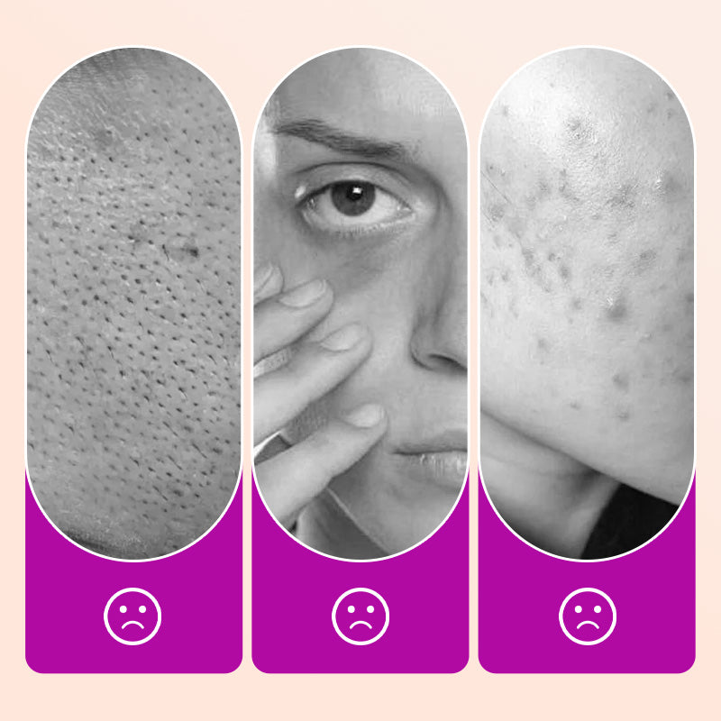 💗ULTIMO GIORNO - ACQUISTA 1 E NE OTTIENI 1 GRATIS!!💗Correttore illuminante impeccabile per il contorno occhi