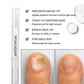 💅🔥ACQUISTA 2, OTTIENI 3 GRATIS! ✨ Penna per Trattamento di Micosi alle Unghie – Azione Rapida, Applicazione Precisa & Effetto Lenitivo 🦶