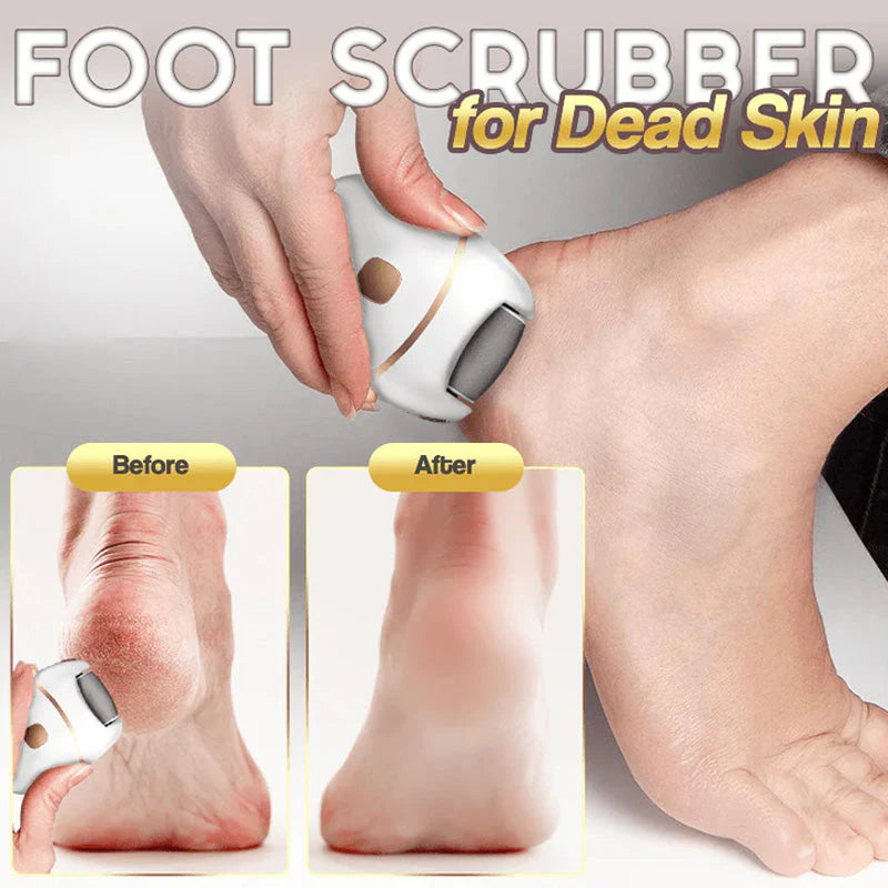 Raspacalli Elettrico Professionale Ricaricabile per Pedicure e Piedi Morbidi