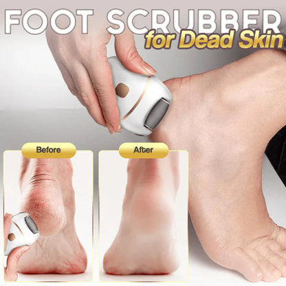 Raspacalli Elettrico Professionale Ricaricabile per Pedicure e Piedi Morbidi