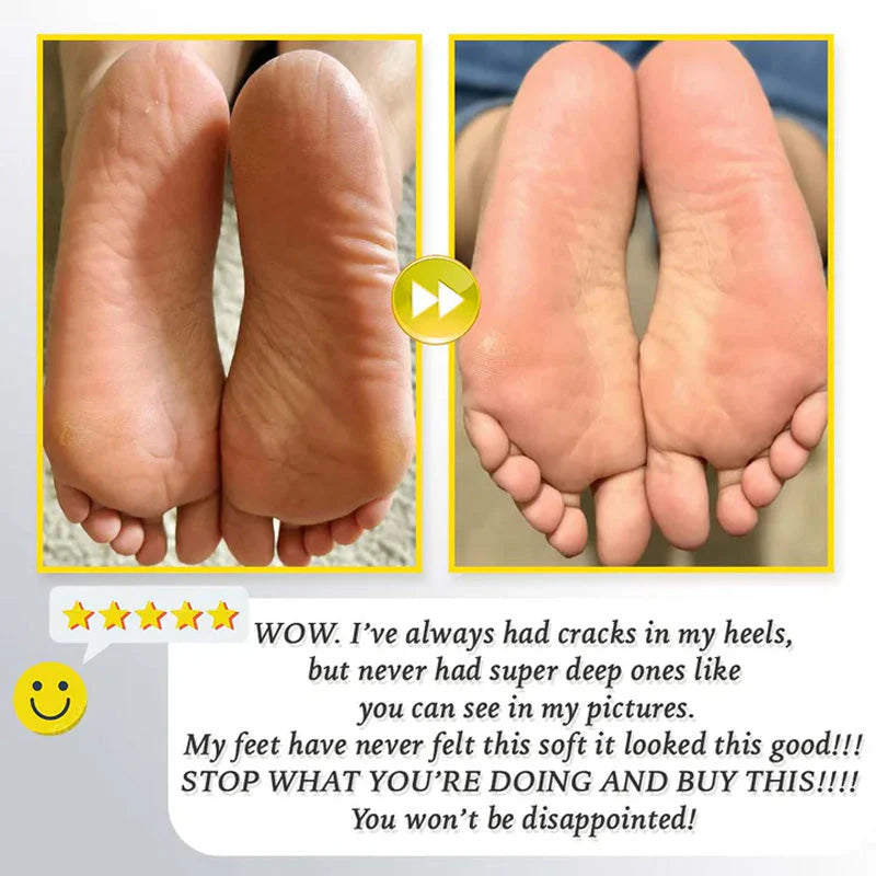 Raspacalli Elettrico Professionale Ricaricabile per Pedicure e Piedi Morbidi
