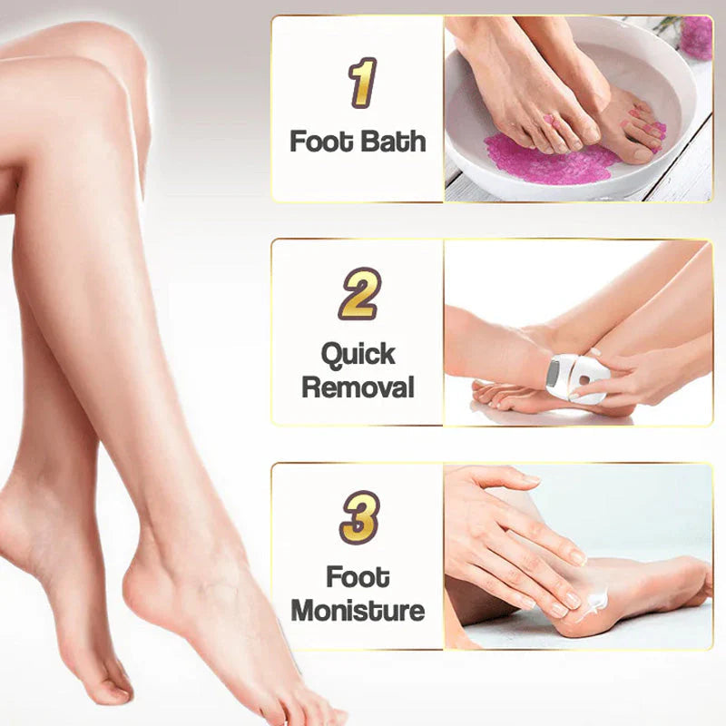 Raspacalli Elettrico Professionale Ricaricabile per Pedicure e Piedi Morbidi