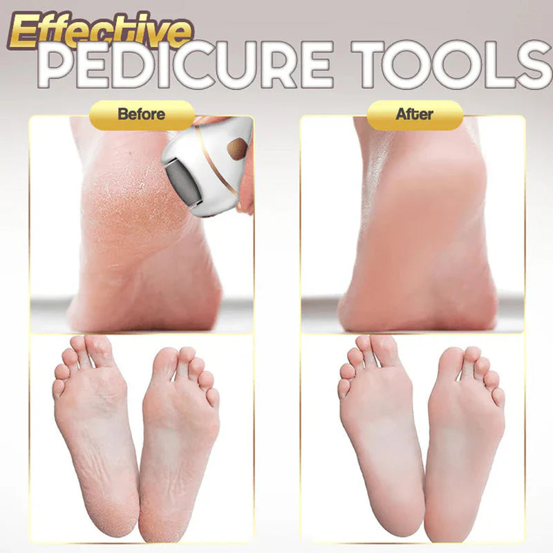 Raspacalli Elettrico Professionale Ricaricabile per Pedicure e Piedi Morbidi