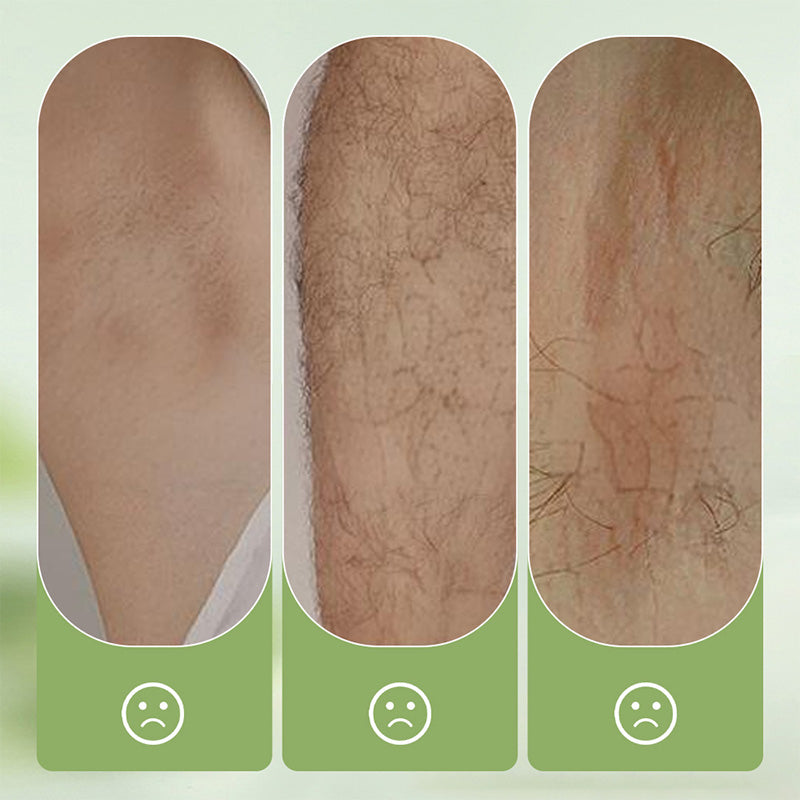 Crema depilatoria delicata e non irritante