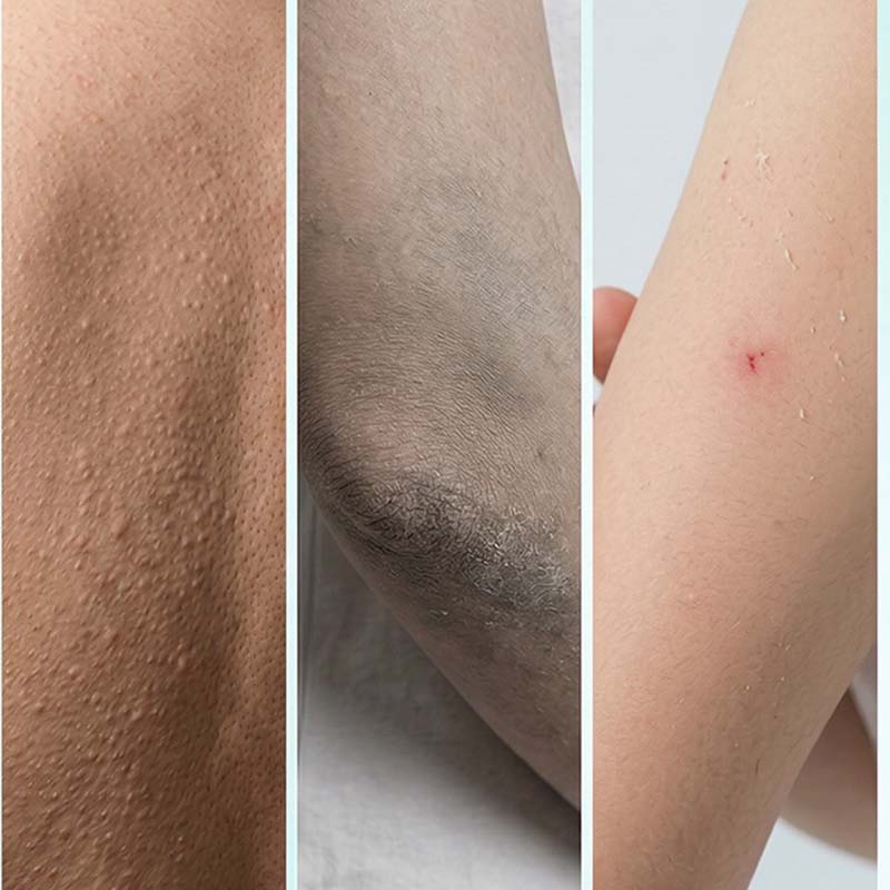 Guanto Esfoliante Idratante per il Corpo e Doccia