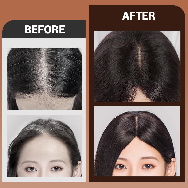 🔥ULTIMO GIORNO 50% DI SCONTO🔥Topper ibrido per attaccatura dei capelli