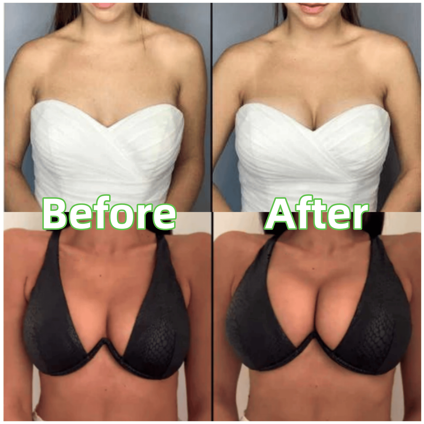 Inserti di Reggiseno Moda Autoadesivi