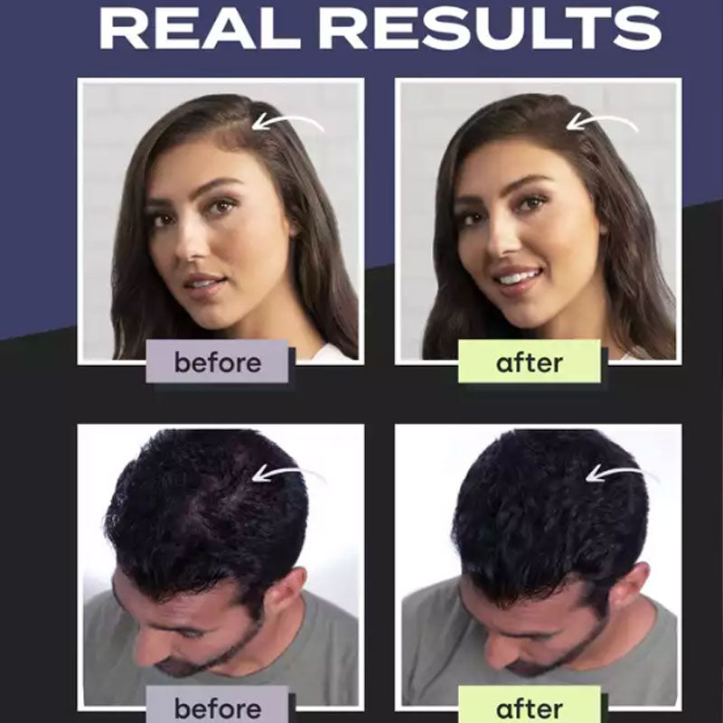💇 Kit di fibre per infoltire i capelli, appositamente studiato per capelli diradati e zone calve – disponibile in 5 colori, impermeabile e resistente al sudore, per un look naturale immediato. Importato dalla Spagna ✨