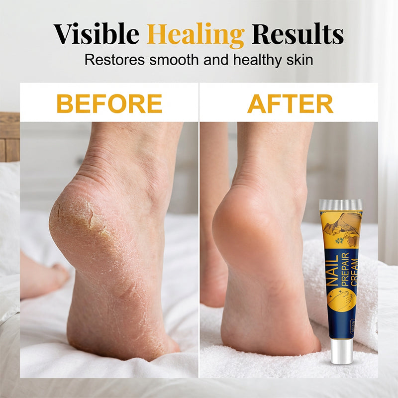 🥳2026 SUPER OFFERTA🥳💞50K+ VENDUTI! 🦶💚 PRENDI 2 PAGHI 1! Crema Piedi Intensiva – idratazione profonda per talloni secchi e screpolati. Gli estratti vegetali riparano e ammorbidiscono: assorbimento rapido, zero effetto unto! 🌿✨