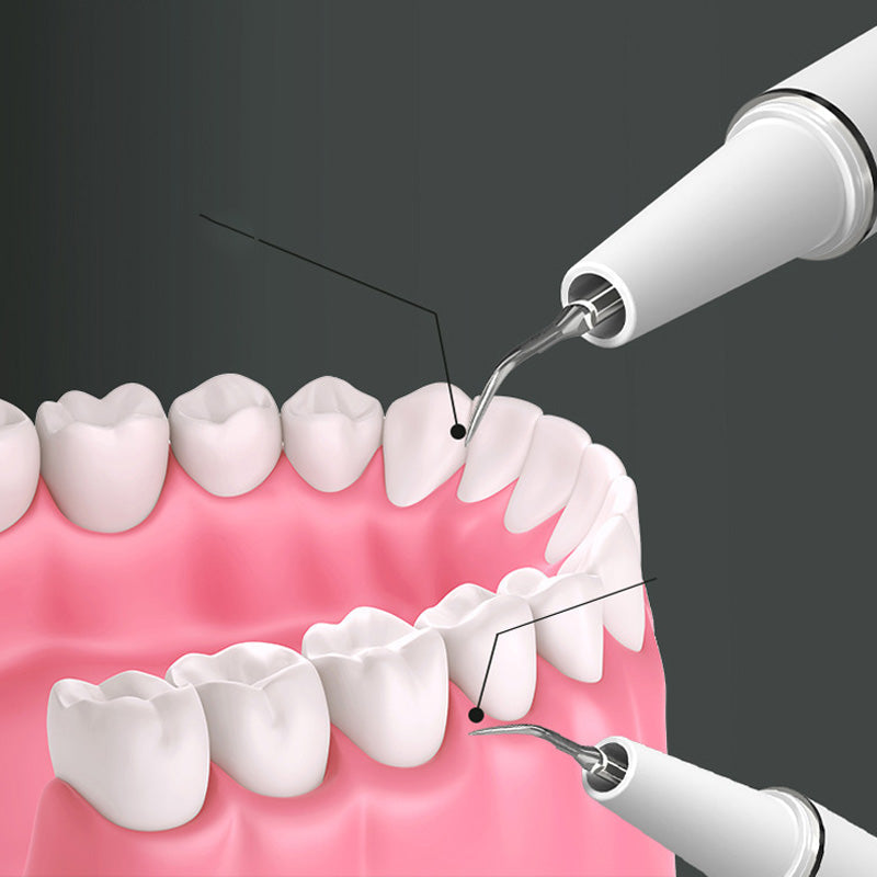 ✨😁🦷✨ Pulitore dentale ultrasonico portatile ad alta efficacia - Cura dentale a 360° a casa! 🚿🦷🌿