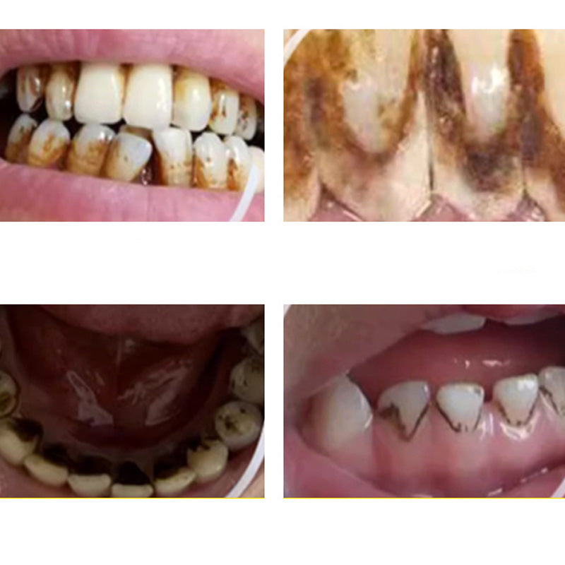✨😁🦷✨ Pulitore dentale ultrasonico portatile ad alta efficacia - Cura dentale a 360° a casa! 🚿🦷🌿