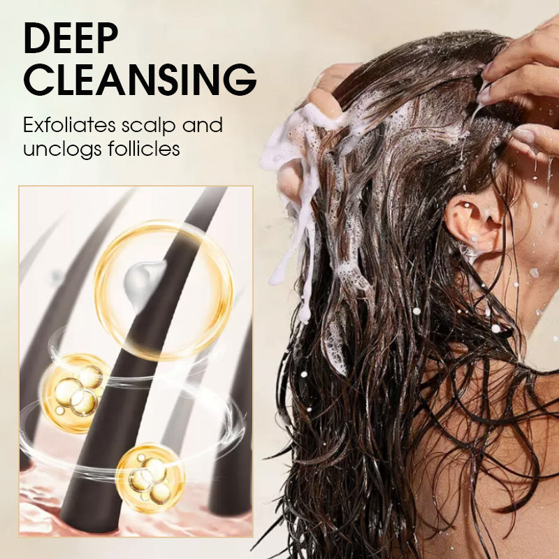 🥳2026 BESTSELLER✨Shampoo antiforfora con disolfuro di selenio e acido salicilico. Riduce squame e prurito, regola il sebo, ripara la barriera del cuoio capelluto. Due varianti: rinfrescante al mentolo o volumizzante, capelli puliti e sani a lungo🧴
